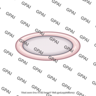 Oval window membranous