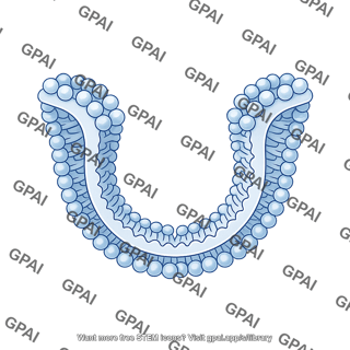 Small vesicle stage 2