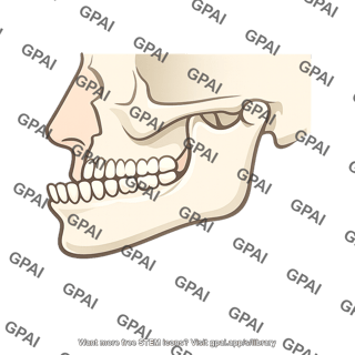 Jaw protruding