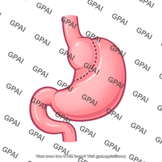 Bariatric surgery