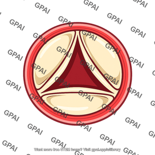 Aortic valve open
