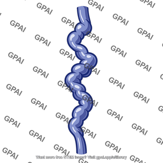 Varicose vein