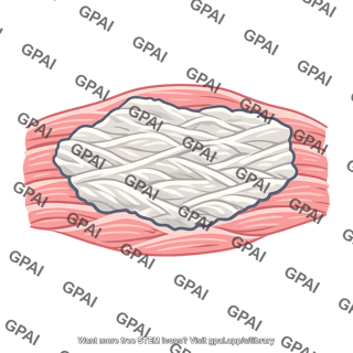 Cardiac fibrosis