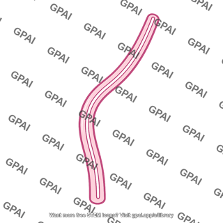 Loop of henle ascending thin limb