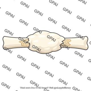 Bone callus