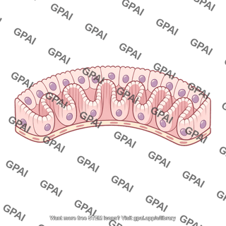 Thyroid epithelium infolded