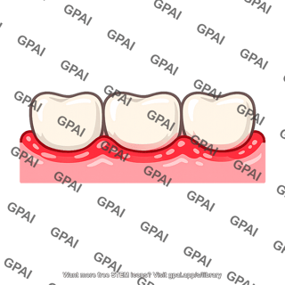 Gingivitis