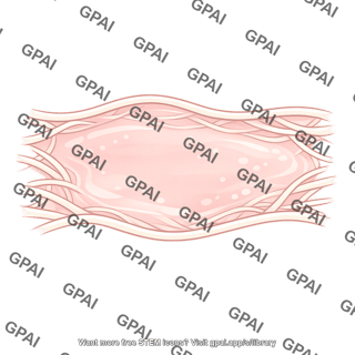 Tissue space