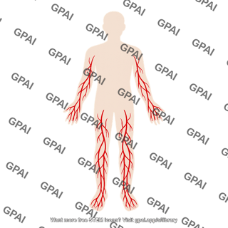 Dilated peripheral vessels