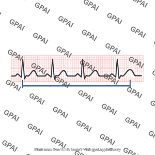 Qt interval prolonged