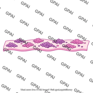 Basement membrane protein deposit