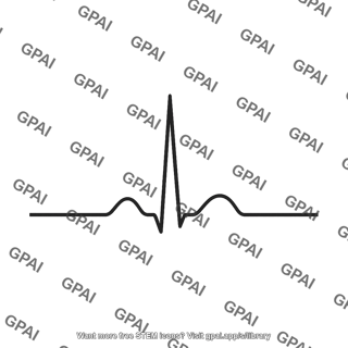 Qrs complex