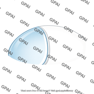 Sclerocorneal junction