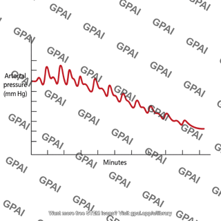 Arterial pressure graph