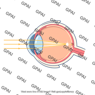 Hyperopia