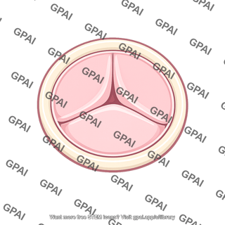 Cardiac valve