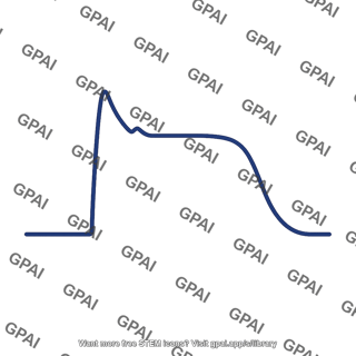 Action potential curve cardiac ventricular