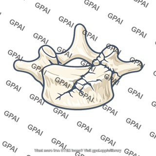 Vertebra fractured
