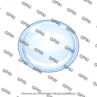 Eye lens very convex