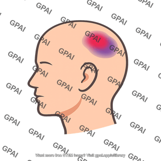 Head injured