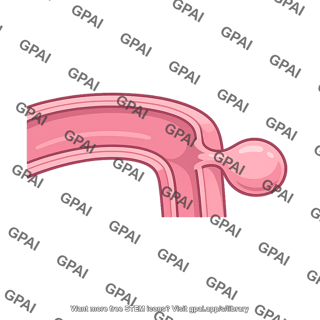 Diverticulum
