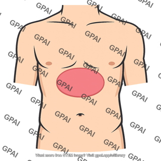 Anterior epigastrium