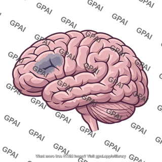 Brain ischemic