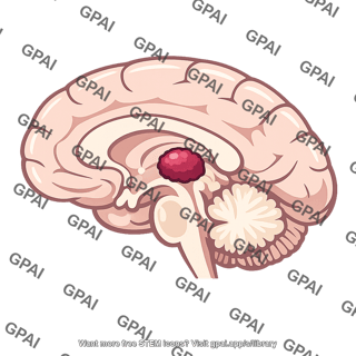 Pineal tumor