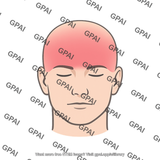 Head pain referred map front half