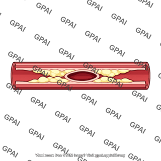 Arteriosclerotic artery