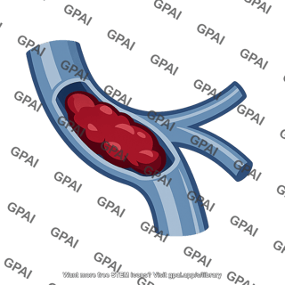 Pulmonary vessel blocked