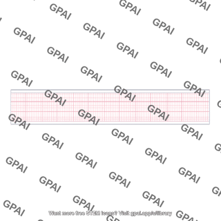 Ecg paper strip