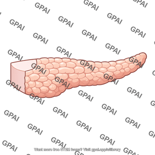 Pancreas head resected