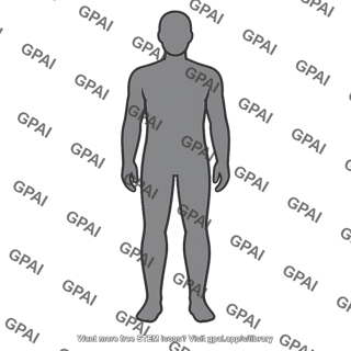 Known object person