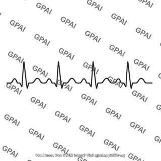 Ecg limb lead tracing
