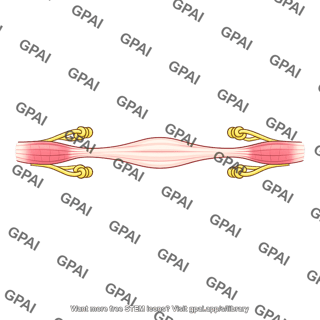 Receptor portion of muscle spindle overstretched