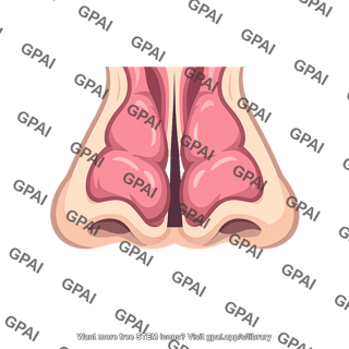 Nasal obstruction