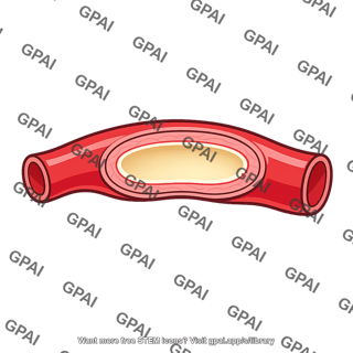 Cerebral arteriole dilated
