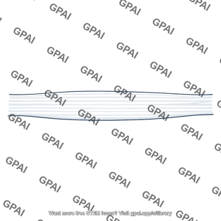 Optic nerve fiber layer