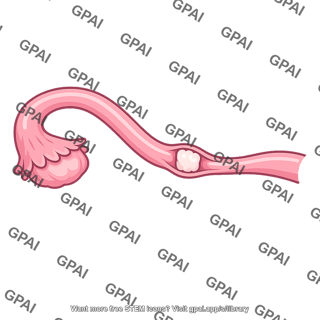 Fallopian tube occluded