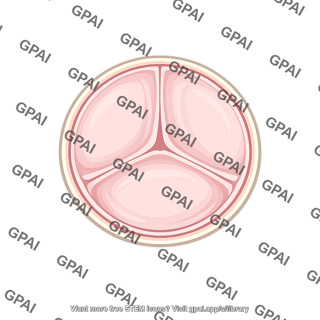 Pulmonic valve