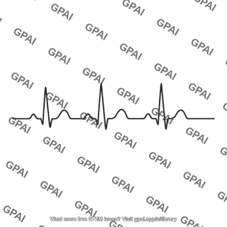 Ecg