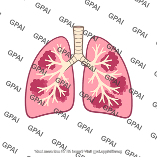 Lung pneumonia