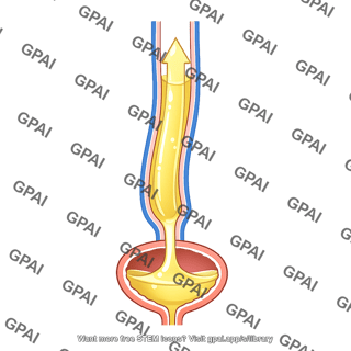 Vesicoureteral reflux