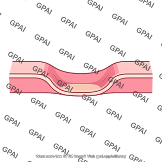 Muscle membrane invagination