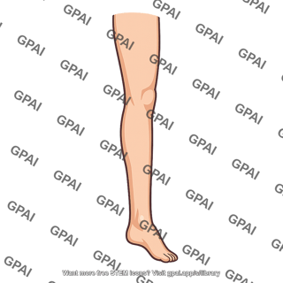 Extended leg