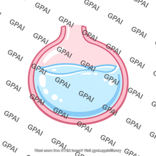 Alveolus fluid filled
