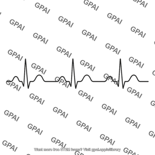 Electrocardiogram trace normal