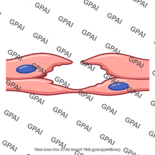 Liver capillary pore wide open