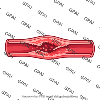 Vascular injury